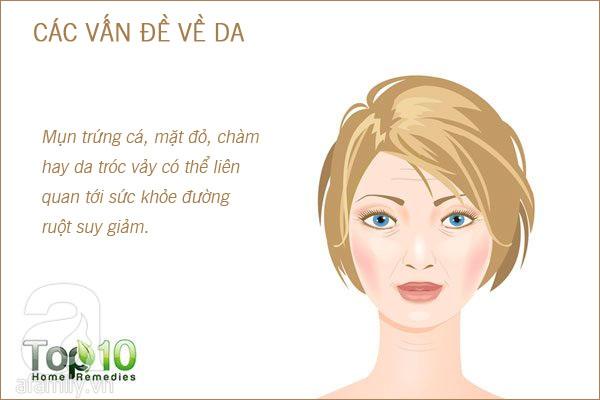 10 dấu hiệu 'tố cáo' đường ruột của bạn đang gặp trục trắc-6