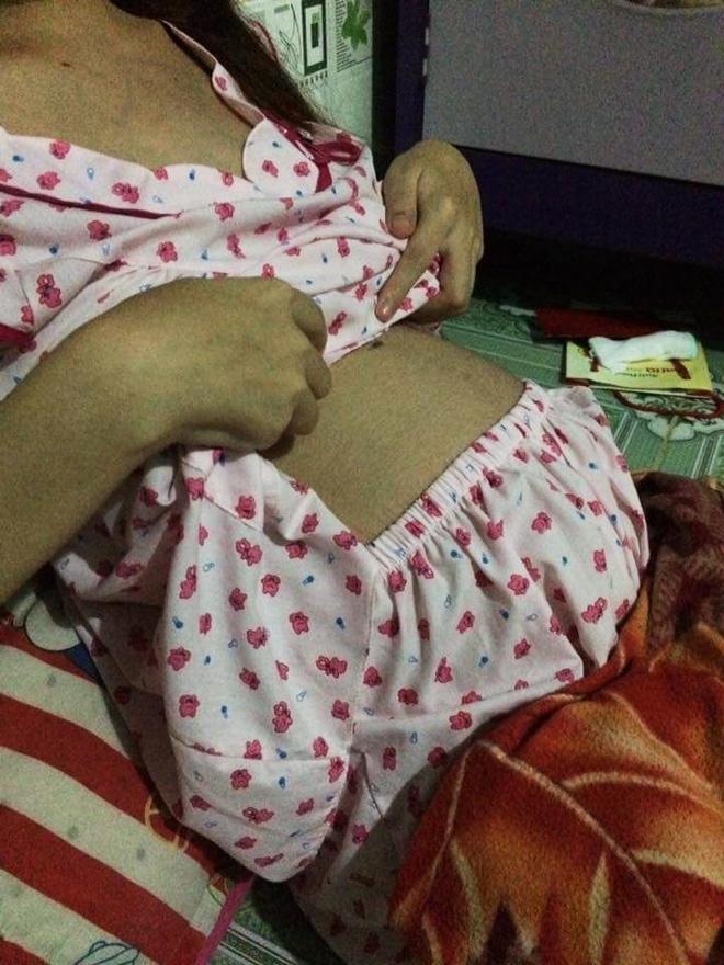 'Giữ mẹ hay giữ con' – câu chuyện xót lòng của thai phụ 20 tuổi đang cận kề án tử-4