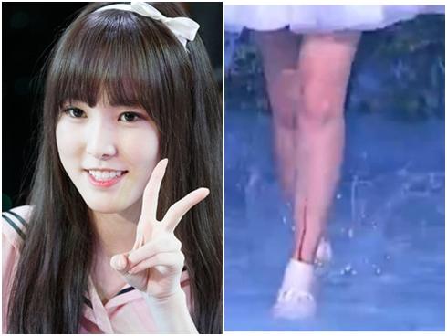 Máu chảy dài trên chân thành viên G-Friend khi đang biểu diễn