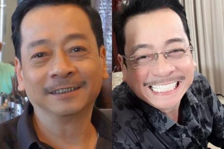 Diễn viên 'Người phán xử' thi nhau 'thay răng'-1