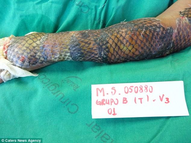 Ai cũng hoảng sợ khi thấy 'cánh tay da rắn' này nhưng sự thật còn bất ngờ hơn-1