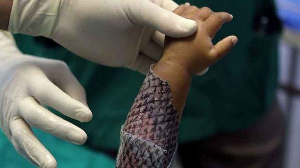 Ai cũng hoảng sợ khi thấy 'cánh tay da rắn' này nhưng sự thật còn bất ngờ hơn-6