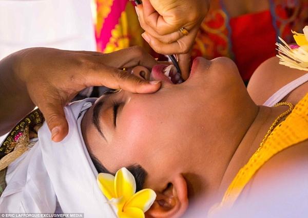 Kỳ lạ: Tục lệ mài răng thiếu niên để xua đuổi tà ma-3