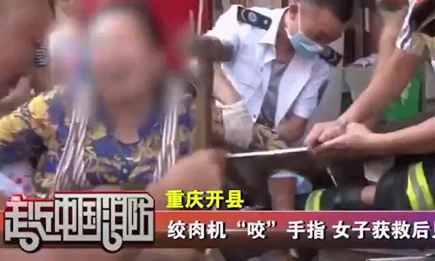 Hi hữu: Một phụ nữ bị máy xay thịt nghiền nát tay khi vệ sinh dụng cụ-2
