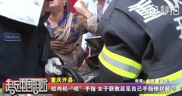 Hi hữu: Một phụ nữ bị máy xay thịt nghiền nát tay khi vệ sinh dụng cụ-1