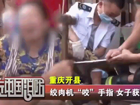 Hi hữu: Một phụ nữ bị máy xay thịt nghiền nát tay khi vệ sinh dụng cụ