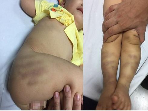 Hành tung bí ẩn của người phụ nữ bỏ lại bé trai 14 tháng tuổi bị bạo hành tại bệnh viện-3