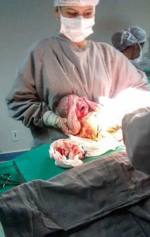 Xúc động giây phút bé sơ sinh vừa chào đời đã ôm chặt mẹ hôn lấy hôn để-3