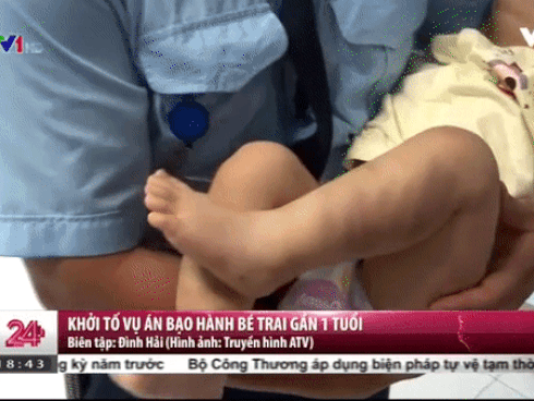 Tin nóng trong ngày 8/8: Bác sĩ 'răng - hàm - mặt' liều làm ngực cho thai phụ khiến bệnh nhân tử vong-3