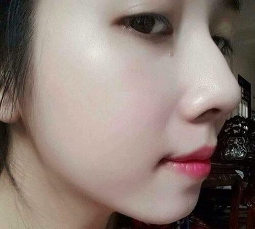 Cho cà chua đông đá rồi chà lên khắp mặt trong vài phút, 10 người dùng 9 người mê-6