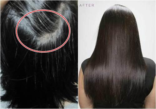 3 cách trị tóc rụng nhiều và bạc sớm với công thức từ 1 quả khế chua-5