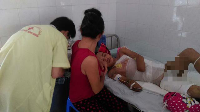 Nỗi đau quặn thắt của chàng trai đi sửa nhà cho bà con sau bão bị điện cao thế đốt cháy 2 tay-1