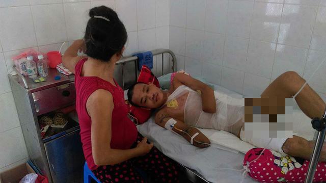 Nỗi đau quặn thắt của chàng trai đi sửa nhà cho bà con sau bão bị điện cao thế đốt cháy 2 tay-3