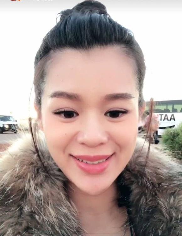 Xuất hiện với gương mặt khác lạ, Hồ Hạnh Nhi bị nghi ngờ mang thai vẫn phẫu thuật-1