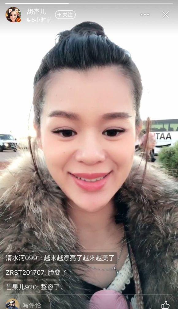 Xuất hiện với gương mặt khác lạ, Hồ Hạnh Nhi bị nghi ngờ mang thai vẫn phẫu thuật-2