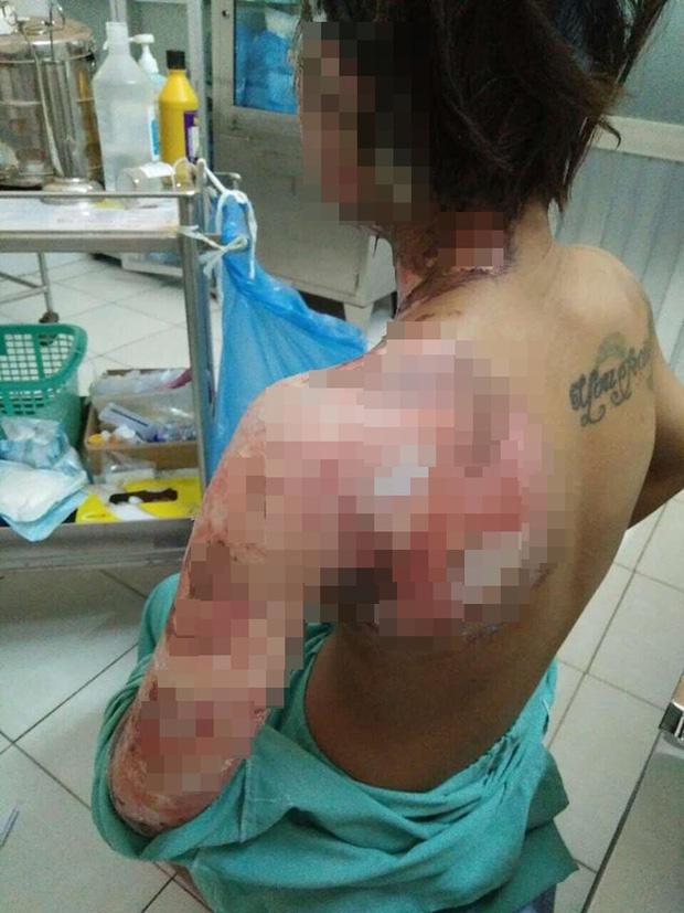 Giận vợ, chồng tưới xăng dọa đốt nhà, lửa bùng cháy gây bỏng cho cả đứa con mới hơn 2 tuổi-1