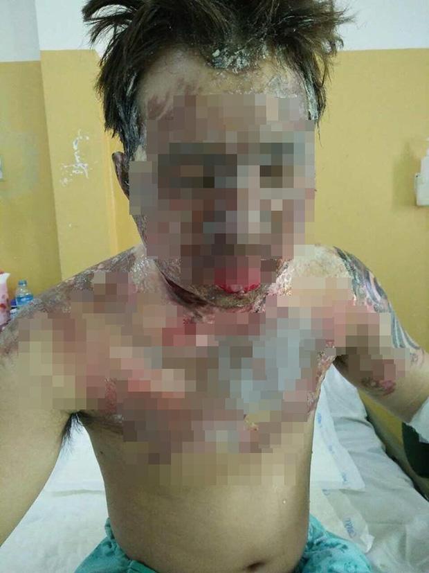 Giận vợ, chồng tưới xăng dọa đốt nhà, lửa bùng cháy gây bỏng cho cả đứa con mới hơn 2 tuổi-3