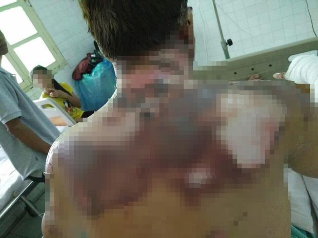 Giận vợ, chồng tưới xăng dọa đốt nhà, lửa bùng cháy gây bỏng cho cả đứa con mới hơn 2 tuổi-4