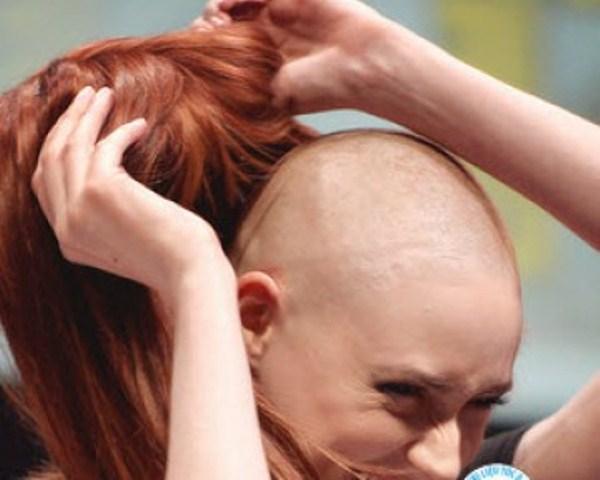 Đối phó với rụng tóc khi điều trị ung thư thế nào?-2