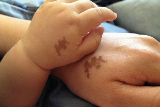 Vị trí của những vết bớt trên cơ thể nói lên bí mật tương lai của bạn?-2