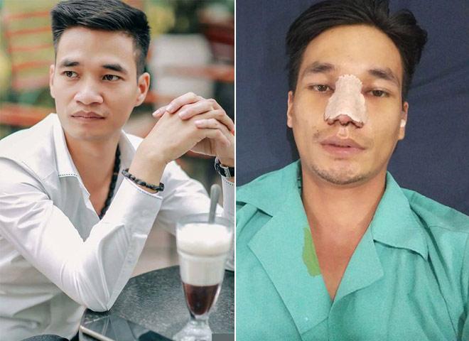 Lệ Rơi gây bất ngờ với khuôn mặt 'nửa Việt nửa Tây' trong bộ ảnh mới-1