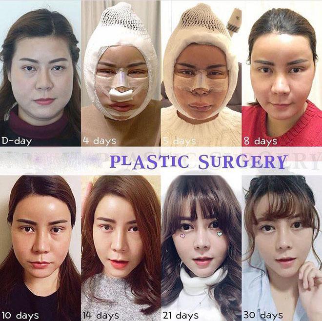 Vỡ mộng vì quá khứ xấu khó tin của loạt nam - nữ thần Thái Lan trước phẫu thuật thẩm mỹ-6