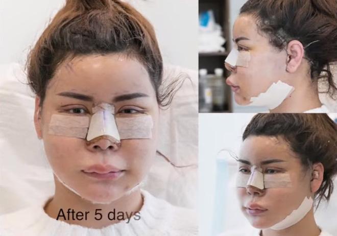 Vỡ mộng vì quá khứ xấu khó tin của loạt nam - nữ thần Thái Lan trước phẫu thuật thẩm mỹ-7