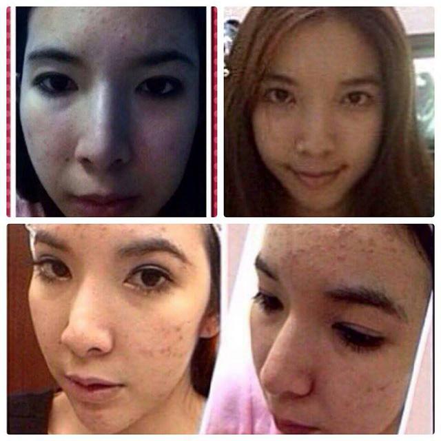 Vỡ mộng vì quá khứ xấu khó tin của loạt nam - nữ thần Thái Lan trước phẫu thuật thẩm mỹ-12