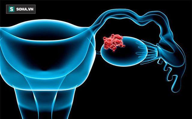 Một triệu chứng không đau báo hiệu tới 3 bệnh ung thư: Nhận ra sớm là yếu tố sống còn-1