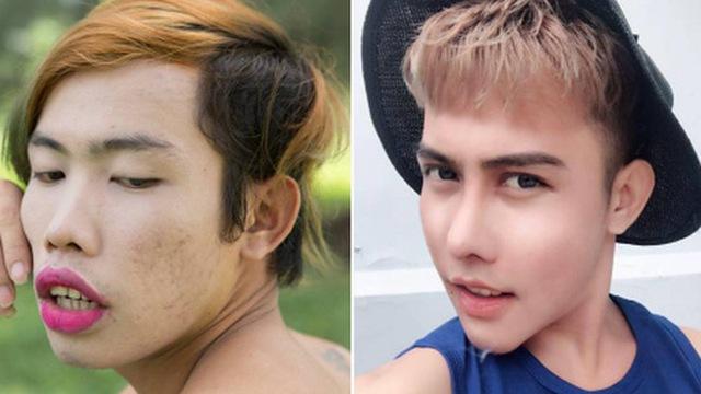 3 ca phẫu thuật thẩm mỹ 'thần thánh' khiến cộng đồng mạng chao đảo-14