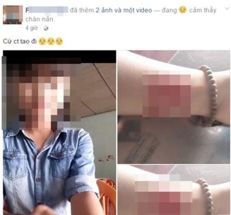 Muôn kiểu THẤT TÌNH phản cảm của giới trẻ thời nay: Rạch tay, xăm kín mặt, mặc áo mưa nằm vật trên sàn nhà-5