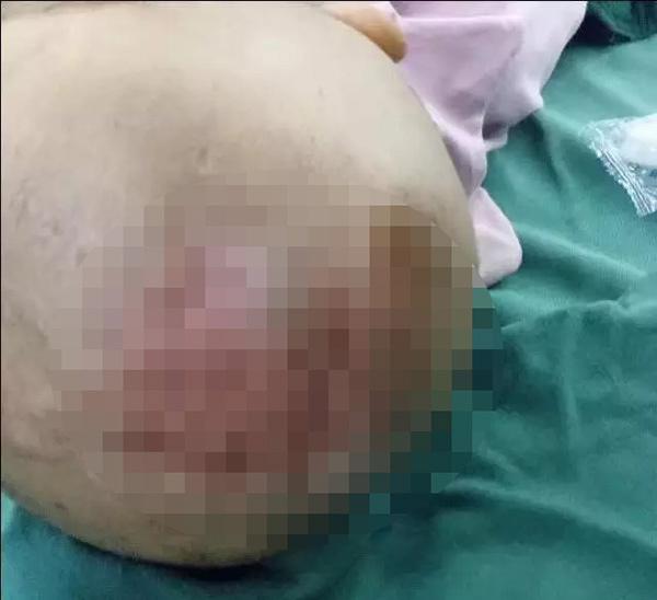 Bé gái 3 tuổi bị bỏng da đầu, kim đâm chi chít ở bụng từ những lần tra tấn dã man của mẹ kế-1