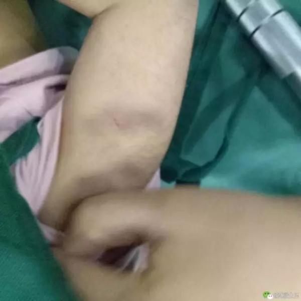 Bé gái 3 tuổi bị bỏng da đầu, kim đâm chi chít ở bụng từ những lần tra tấn dã man của mẹ kế-5