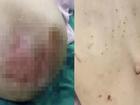 Bé gái 3 tuổi bị bỏng da đầu, kim đâm chi chít ở bụng từ những lần tra tấn dã man của mẹ kế