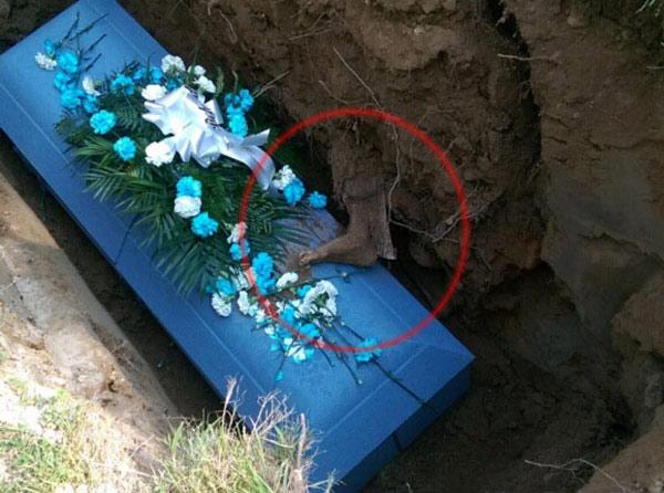 Chôn cất người cha quá cố, cả gia đình 'lạnh gáy' khi thấy bàn chân đang phân hủy trên quan tài-1