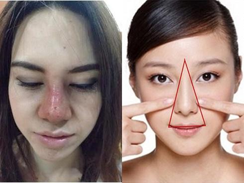 Đánh bay mụn bọc sưng đỏ 2 bên má, da dẻ lại còn trắng nõn nhờ nguyên liệu cây nhà lá vườn này-4