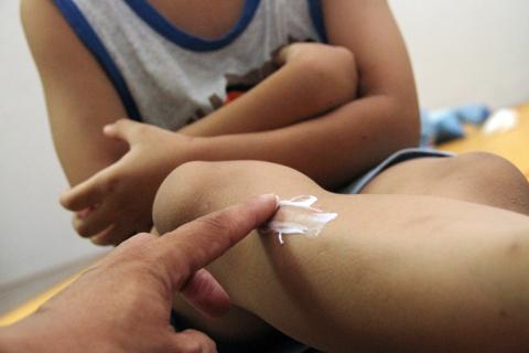 Sử dụng thuốc chống muỗi, côn trùng: Dùng sai, rước độc vào người-2