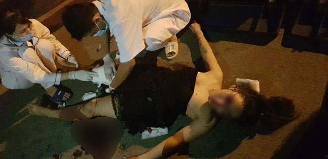 Xe máy 'kẹp' 5 tông dải phân cách, 4 cô gái trẻ văng tứ tung-3