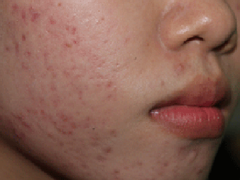 Tin nóng trong ngày 16/8: Video 2 phụ nữ hắt dầu luyn vào phản thịt lợn ‘giá rẻ’ lĩnh 9 tháng tù treo-7