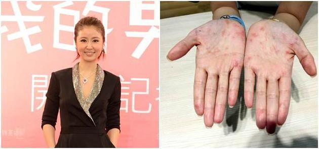 Lâm Tâm Như, Triệu Lệ Dĩnh và cái giá phải trả cho sự nổi tiếng-4