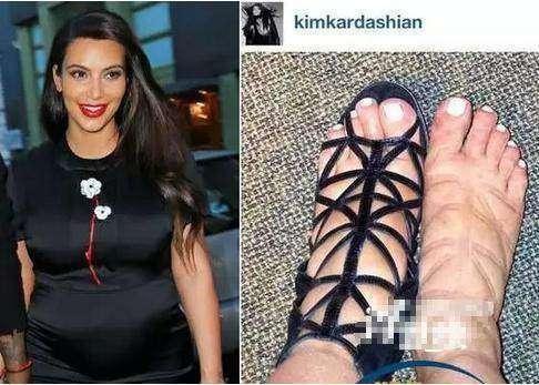 Kinh hãi những màn tra tấn chân trên giày cao gót của các ngôi sao-11