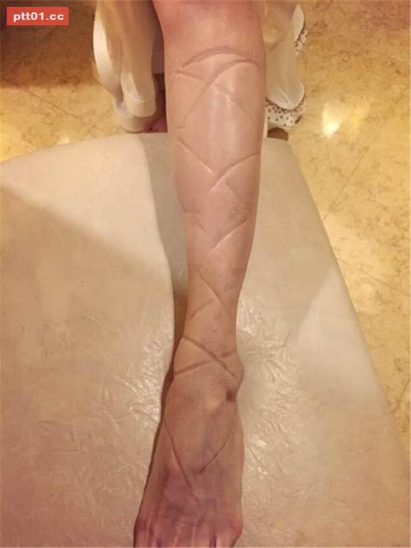 Kinh hãi những màn tra tấn chân trên giày cao gót của các ngôi sao-9