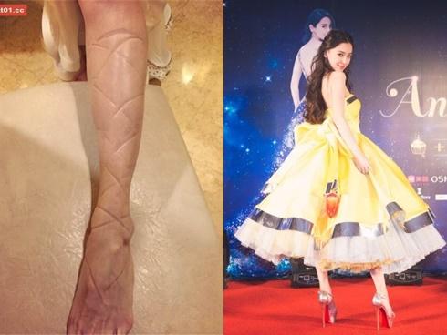 Kinh hãi những màn tra tấn chân trên giày cao gót của các ngôi sao