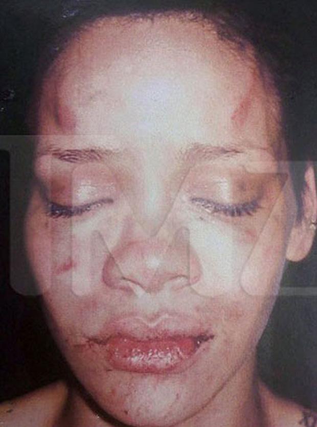 Chris Brown kể sự thật về đêm hành hung Rihanna bầm mặt: 'Cô ấy đánh và nhổ máu vào mặt tôi'-3