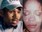 Chris Brown kể sự thật về đêm hành hung Rihanna bầm mặt: 'Cô ấy đánh và nhổ máu vào mặt tôi'