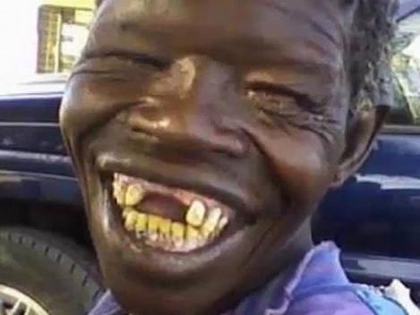 Phẫu thuật thẩm mỹ để thành người 'xấu nhất thế gian'