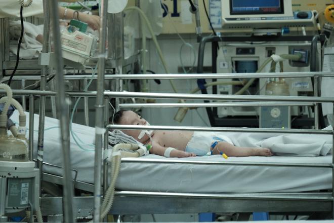 Vắt chanh vào miệng khi trẻ lên cơn co giật, mẹ suýt giết con vì sai lầm chết người-3