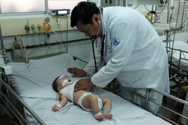 Vắt chanh vào miệng khi trẻ lên cơn co giật, mẹ suýt giết con vì sai lầm chết người-6