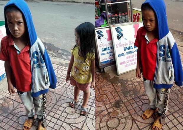 Hình ảnh bé trai bị xích chân giữa chợ khiến nhiều người bức xúc-1