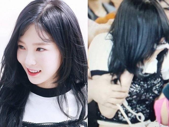 Taeyeon biểu diễn với cánh tay bầm tím sau sự cố bị sàm sỡ ở sân bay-4
